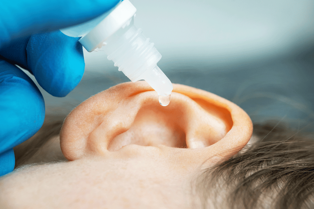 hydrogen peroxide drops being put into an ear
